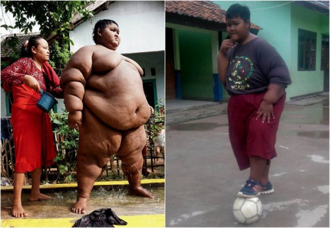 Самый толстый мальчик в мире похудел на 76 кг