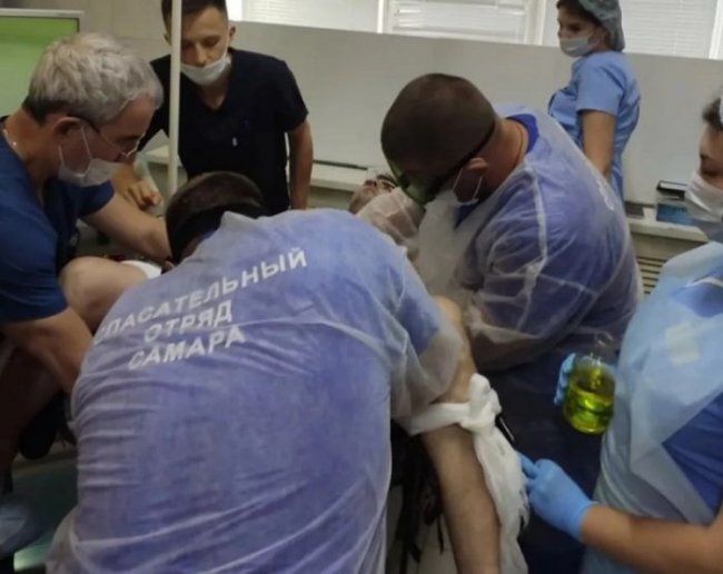 Спасателям пришлось болгаркой спиливать гайку, которую мужчина навинтил на свой пенис